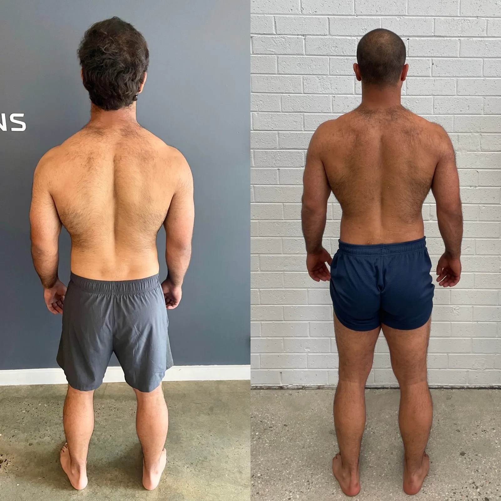 Albert before and after, back view