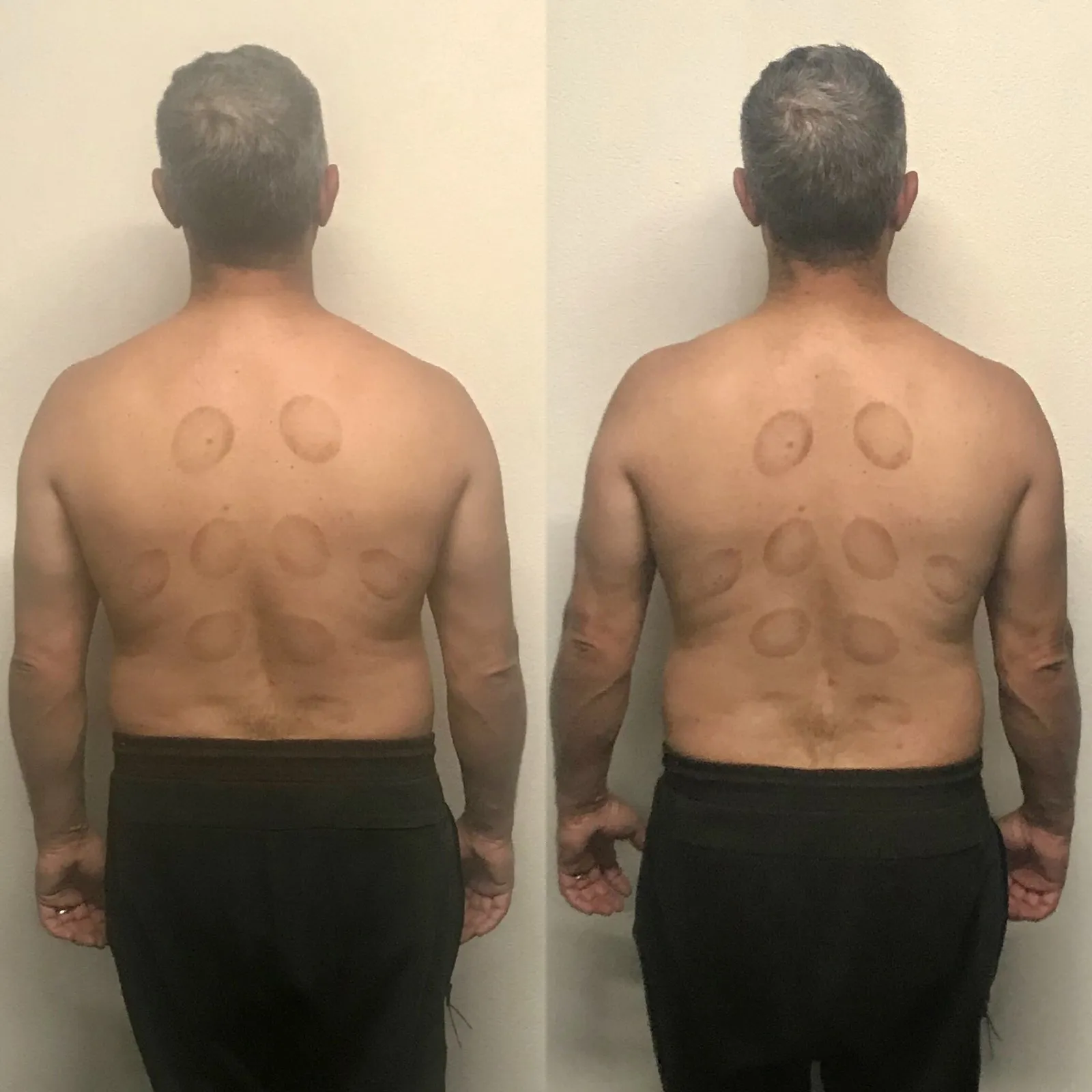 Giuseppe before and after, back view