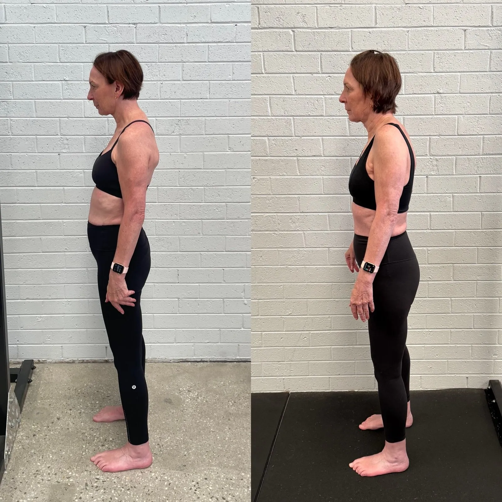 Julie before and after, side view